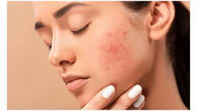 well health organic best ways to remove dark spots on face